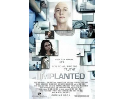 Имплант смотреть онлайн Имплант смотреть онлайн
